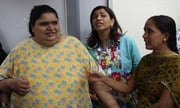 UN body says Many Indians are becoming fatter, many unnourished 